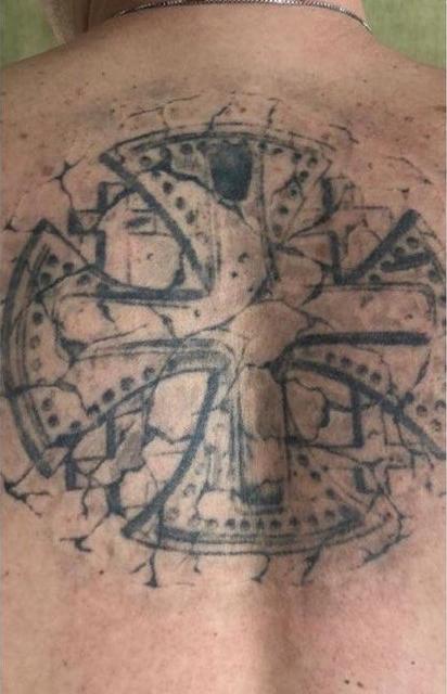 Удаление тату - результат процедур, фото 7