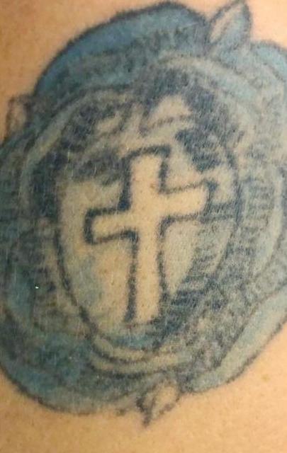 Удаление тату - результат процедур, фото 4