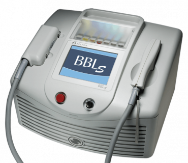 BBL (Broad Band Light) - результат процедур, фото 4